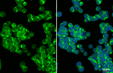 Anti-CD81 antibody [HL1666] used in Immunocytochemistry/ Immunofluorescence (ICC/IF). GTX637264