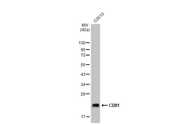 Anti-CD81 antibody [HL1666] used in Western Blot (WB). GTX637264