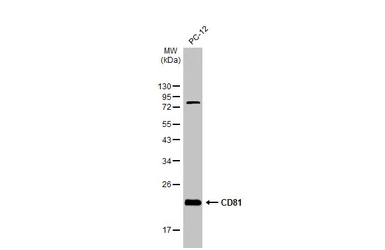 Anti-CD81 antibody [HL1666] used in Western Blot (WB). GTX637264