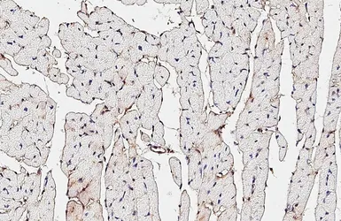 Anti-CD81 antibody [HL1666] used in IHC (Paraffin sections) (IHC-P). GTX637264