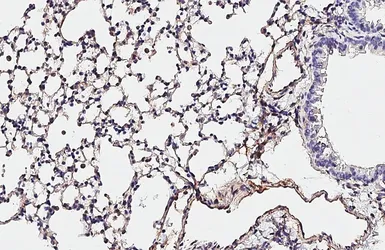 Anti-CD81 antibody [HL1666] used in IHC (Paraffin sections) (IHC-P). GTX637264