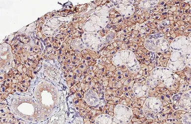Anti-CD81 antibody [HL1666] used in IHC (Paraffin sections) (IHC-P). GTX637264