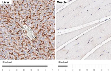 Anti-CD81 antibody [HL1666] used in IHC (Paraffin sections) (IHC-P). GTX637264