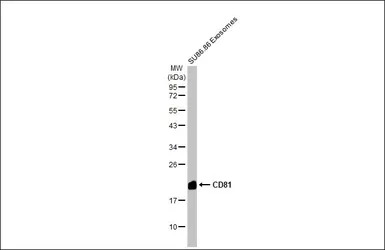 Anti-CD81 antibody [HL1667] used in Western Blot (WB). GTX637265