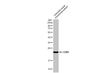 Anti-CD81 antibody [HL1667] used in Western Blot (WB). GTX637265