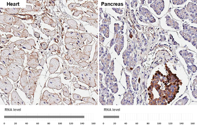 Anti-CD81 antibody [HL1667] used in IHC (Paraffin sections) (IHC-P). GTX637265