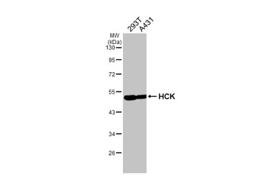 Anti-HCK antibody [HL1673] used in Western Blot (WB). GTX637272