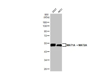 Anti-MAT1A + MAT2A antibody [HL1679] used in Western Blot (WB). GTX637278