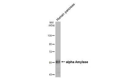 Anti-alpha Amylase antibody [HL1681] used in Western Blot (WB). GTX637280