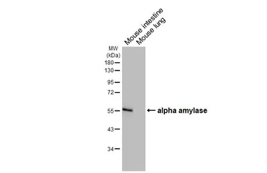 Anti-alpha Amylase antibody [HL1681] used in Western Blot (WB). GTX637280