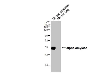 Anti-alpha Amylase antibody [HL1681] used in Western Blot (WB). GTX637280