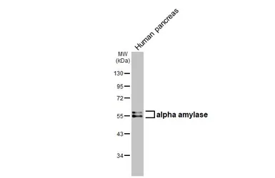 Anti-alpha Amylase antibody [HL1681] used in Western Blot (WB). GTX637280