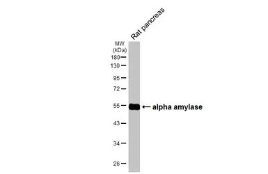 Anti-alpha Amylase antibody [HL1681] used in Western Blot (WB). GTX637280