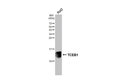 Anti-TCEB1 antibody [HL1683] used in Western Blot (WB). GTX637282