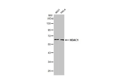 Anti-HDAC1 antibody [HL1691] used in Western Blot (WB). GTX637290