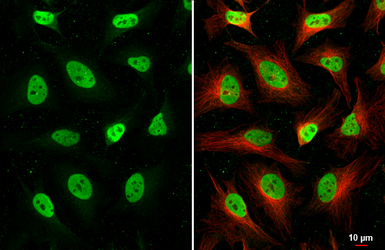 Anti-HDAC1 antibody [HL1691] used in Immunocytochemistry/ Immunofluorescence (ICC/IF). GTX637290