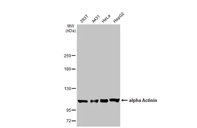 Anti-alpha Actinin antibody [HL1692] used in Western Blot (WB). GTX637291