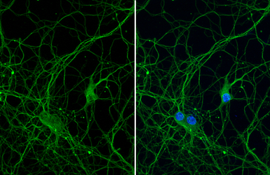 Anti-beta Tubulin 3/ Tuj1 antibody [HL1708] used in Immunocytochemistry/ Immunofluorescence (ICC/IF). GTX637307