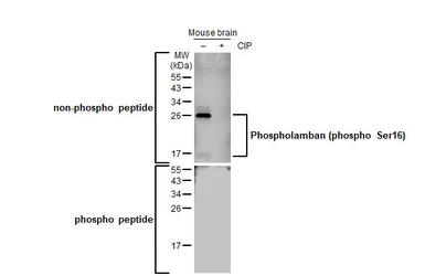Anti-Phospholamban (phospho Ser16) antibody [HL1710] used in Western Blot (WB). GTX637309