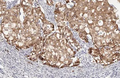 Anti-LASS2 antibody [HL1717] used in IHC (Paraffin sections) (IHC-P). GTX637316