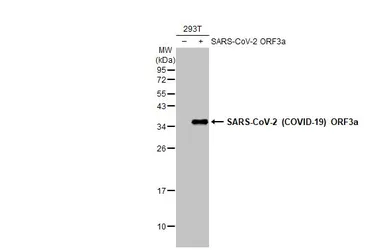 Anti-SARS-CoV-2 (COVID-19) ORF3a antibody [HL1722] used in Western Blot (WB). GTX637321