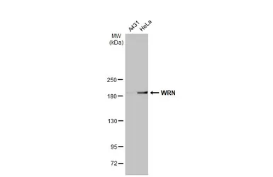 Anti-WRN antibody [HL1729] used in Western Blot (WB). GTX637377