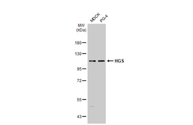 Anti-HGS antibody [HL1730] used in Western Blot (WB). GTX637378