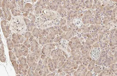 Anti-HGS antibody [HL1730] used in IHC (Paraffin sections) (IHC-P). GTX637378