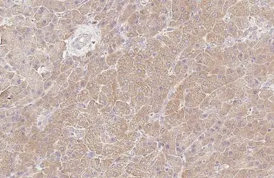 Anti-HGS antibody [HL1730] used in IHC (Paraffin sections) (IHC-P). GTX637378
