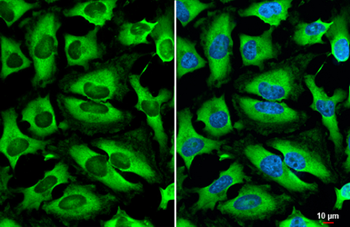 Anti-HGS antibody [HL1730] used in Immunocytochemistry/ Immunofluorescence (ICC/IF). GTX637378
