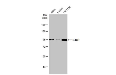 Anti-B-Raf antibody [HL1735] used in Western Blot (WB). GTX637383