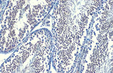 Anti-B-Raf antibody [HL1735] used in IHC (Paraffin sections) (IHC-P). GTX637383