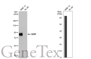 Anti-HHIP antibody [HL1737] used in Western Blot (WB). GTX637385