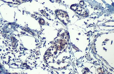 Anti-HHIP antibody [HL1737] used in IHC (Paraffin sections) (IHC-P). GTX637385