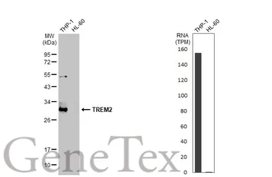 Anti-TREM2 antibody [HL1738] used in Western Blot (WB). GTX637386