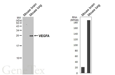 Anti-VEGFA antibody [HL1755] used in Western Blot (WB). GTX637405