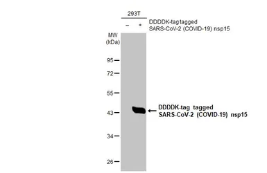 Anti-SARS-CoV-2 (COVID-19) nsp15 antibody [HL1760] used in Western Blot (WB). GTX637410