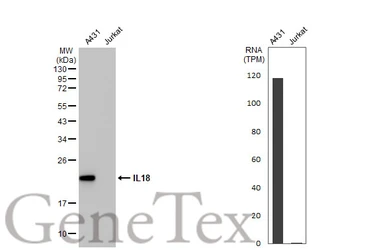 Anti-IL18 antibody [HL1761] used in Western Blot (WB). GTX637411