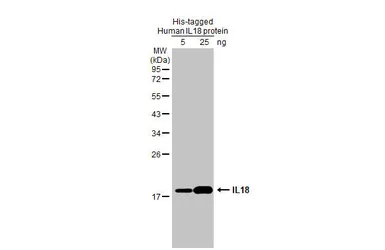 Anti-IL18 antibody [HL1761] used in Western Blot (WB). GTX637411