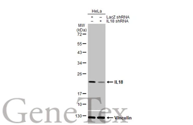 Anti-IL18 antibody [HL1761] used in Western Blot (WB). GTX637411