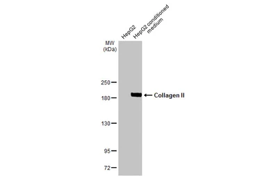 Anti-Collagen II antibody [HL1772] used in Western Blot (WB). GTX637424