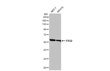 Anti-FRS2 antibody [HL1774] used in Western Blot (WB). GTX637426