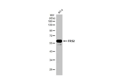 Anti-FRS2 antibody [HL1774] used in Western Blot (WB). GTX637426