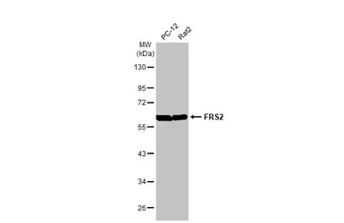 Anti-FRS2 antibody [HL1774] used in Western Blot (WB). GTX637426