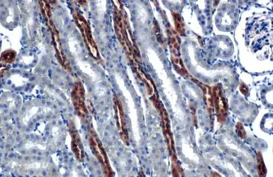 Anti-FRS2 antibody [HL1774] used in IHC (Paraffin sections) (IHC-P). GTX637426