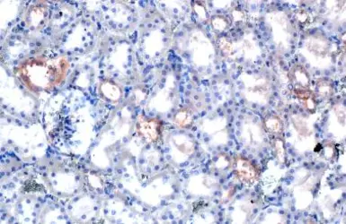 Anti-FRS2 antibody [HL1774] used in IHC (Paraffin sections) (IHC-P). GTX637426
