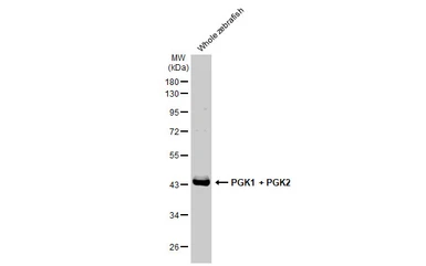 Anti-PGK1 + PGK2 antibody [HL1775] used in Western Blot (WB). GTX637427