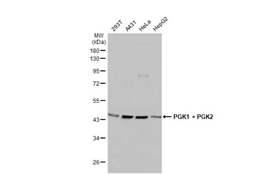 Anti-PGK1 + PGK2 antibody [HL1775] used in Western Blot (WB). GTX637427