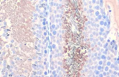Anti-PGK1 + PGK2 antibody [HL1775] used in IHC (Paraffin sections) (IHC-P). GTX637427