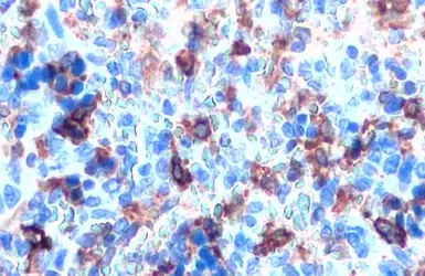 Anti-Heme Oxygenase 1 antibody [HL1780] used in IHC (Paraffin sections) (IHC-P). GTX637432